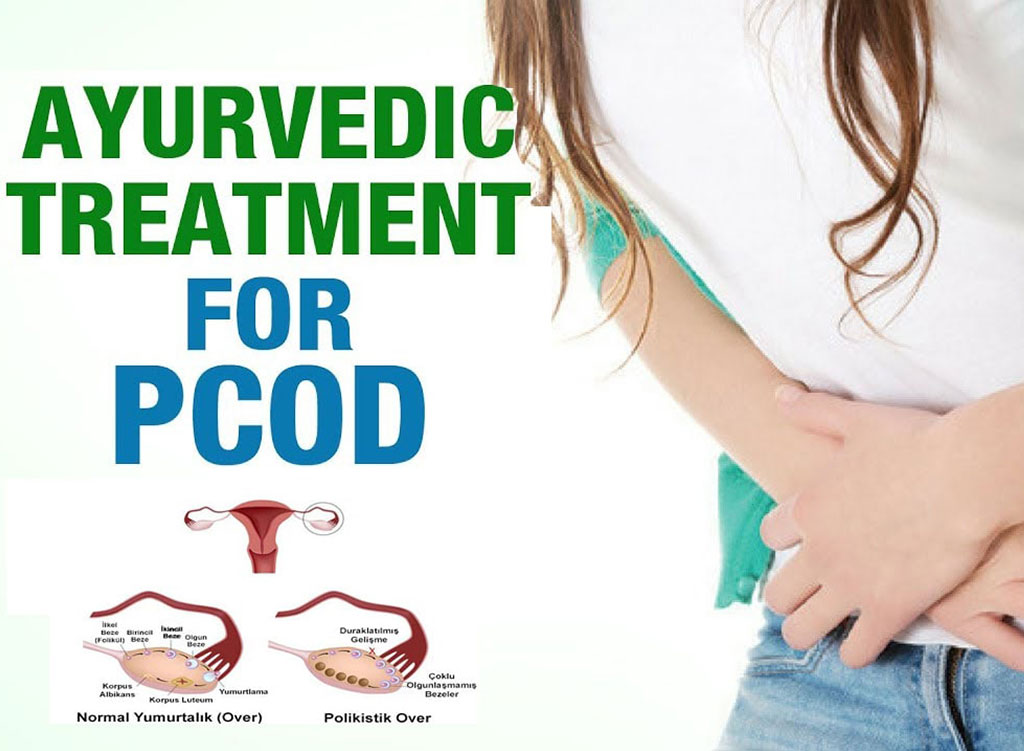 Ayurvedic Treatment for PCOS/PCOD.